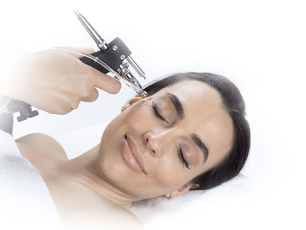 IONO Jet + Sensitive Peel Active Ingredient