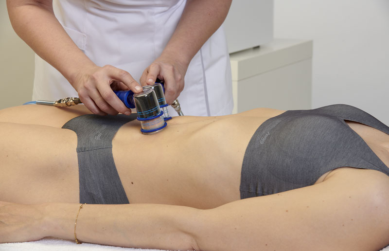 SPM® – Targeted Tissue Stimulation